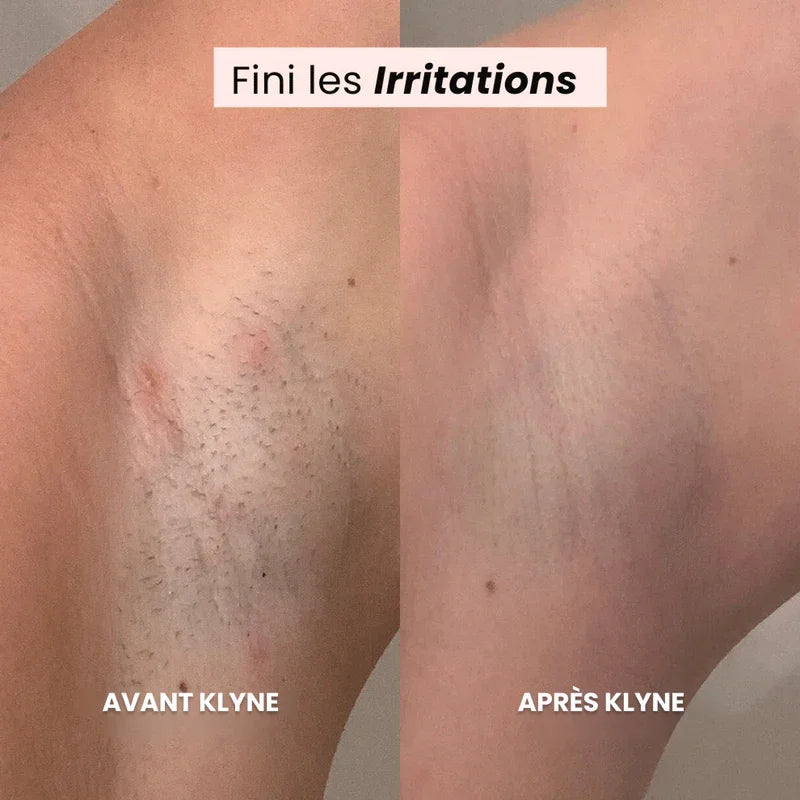 Rasoir Rave® (Coupe Beaucoup + Livraison Gratuite)