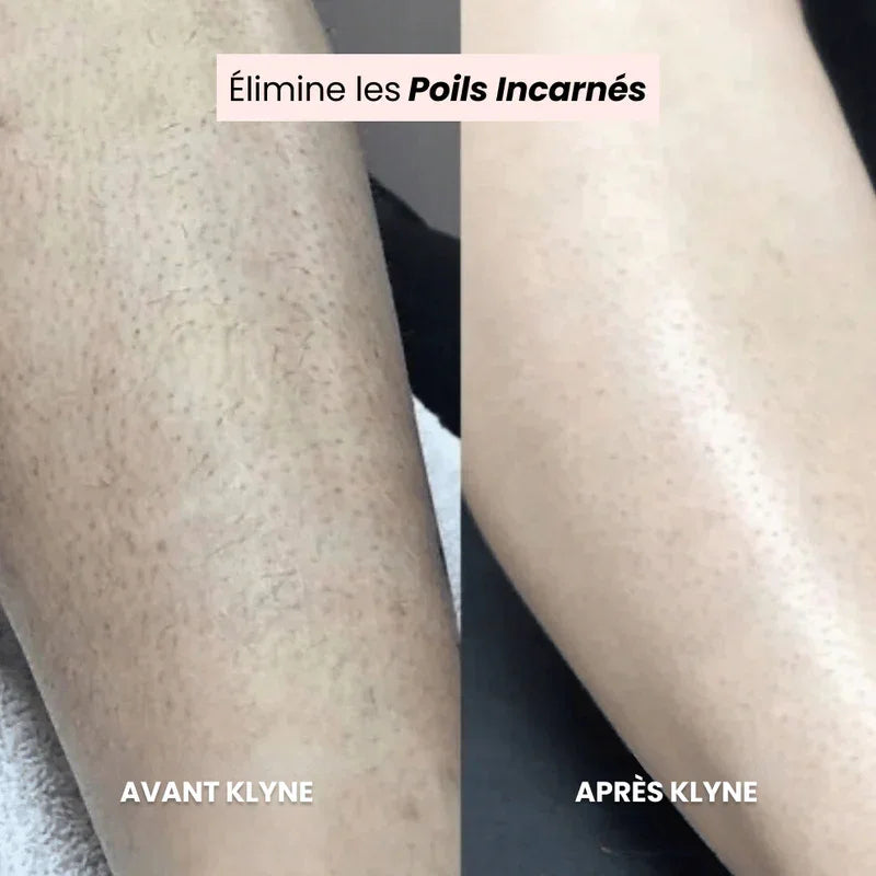 Rasoir Rave® (Coupe Beaucoup + Livraison Gratuite)